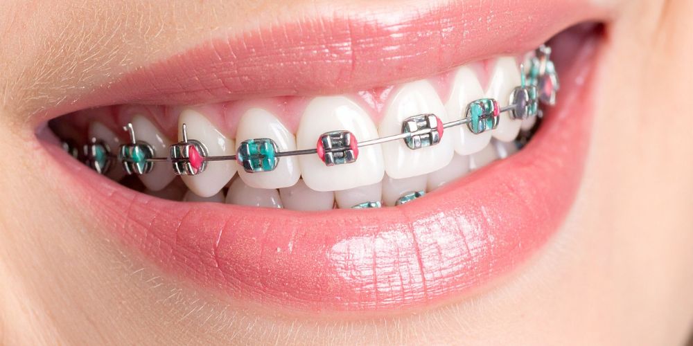Crowns and bridges in lucknow, Best dentures in lucknow, Best maxillofacial surgeon in lucknow, Best dentist in Lucknow, dentist in Lucknow