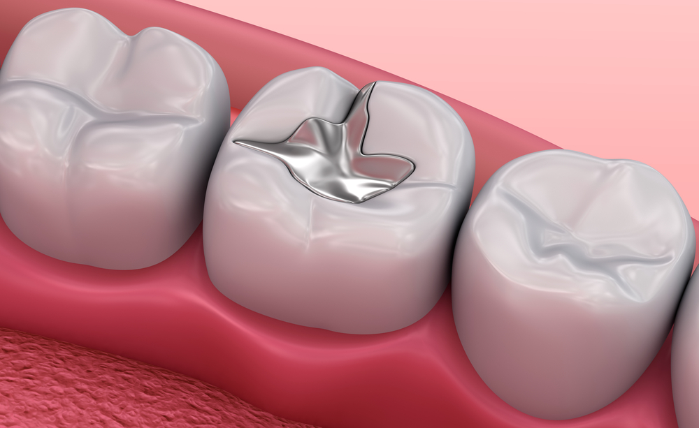 Crowns and bridges in lucknow, Best dentures in lucknow, Best maxillofacial surgeon in lucknow, Best dentist in Lucknow, dentist in Lucknow